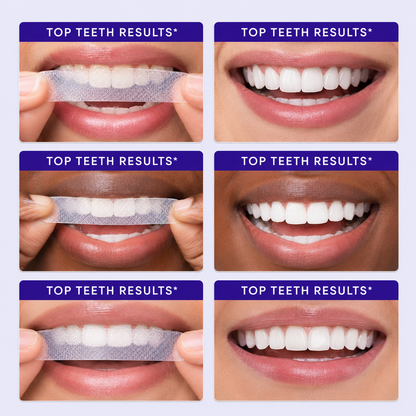 Feimuko Purple Teeth Whitening Strips
