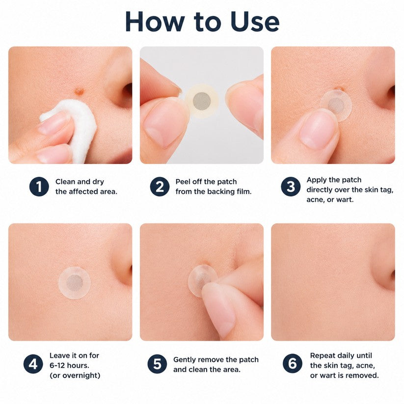 🌟 2-in-1 Microneedle & Hydrocolloid Patch 🌿 Invisible Face & Body Patches for Raised Moles, Acne, Flat Warts & Skin Tags - Helps Improve the Appearance of Wrinkles, Scars & Blemishes